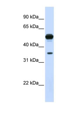 Polyclonal Rabbit anti-Human DDAH1 Antibody (aa108-157, IHC, WB)