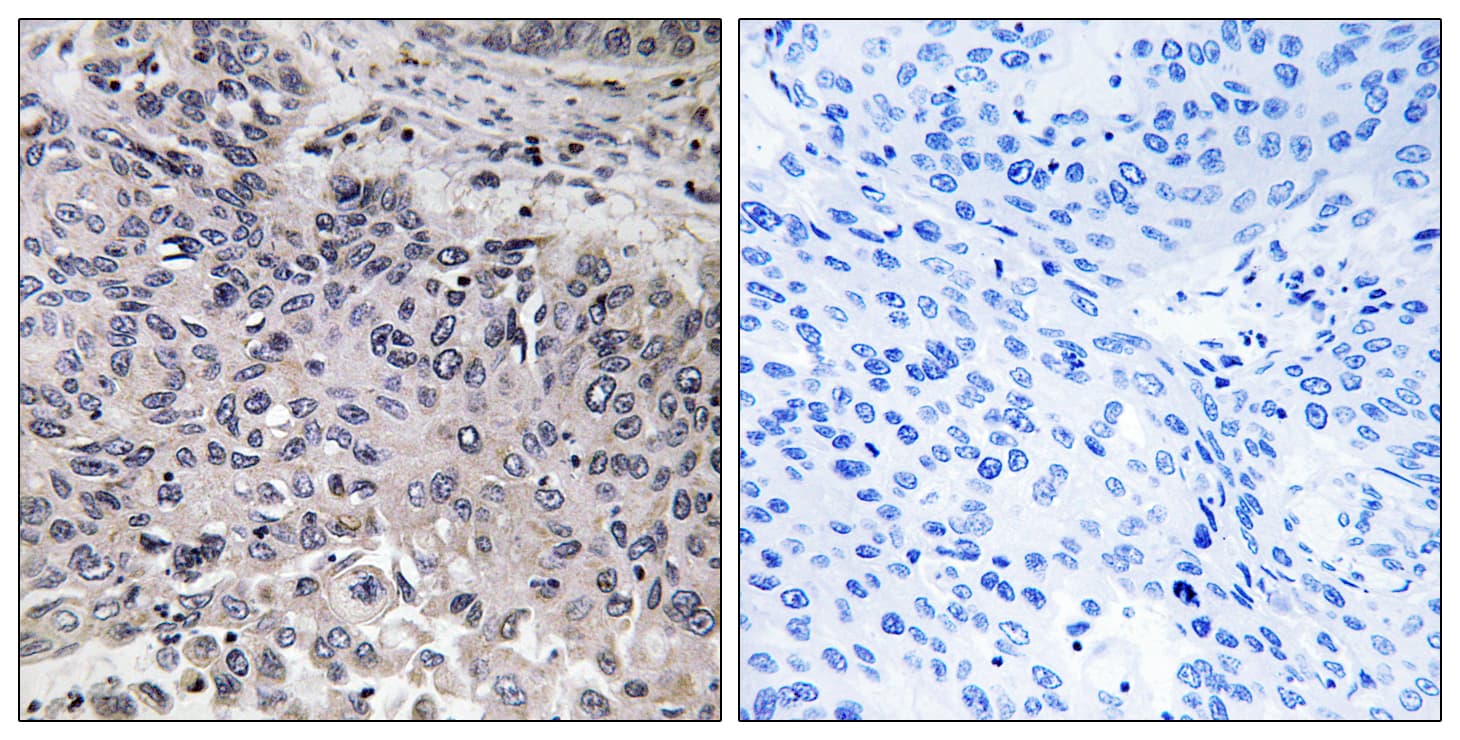 C1QG / Complement C1QC Antibody (aa81-130)