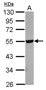 HYAL2 Antibody (Internal)