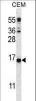 TMEM254 / C10orf57 Antibody (aa96-123)
