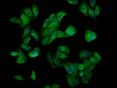 CUL7 Antibody