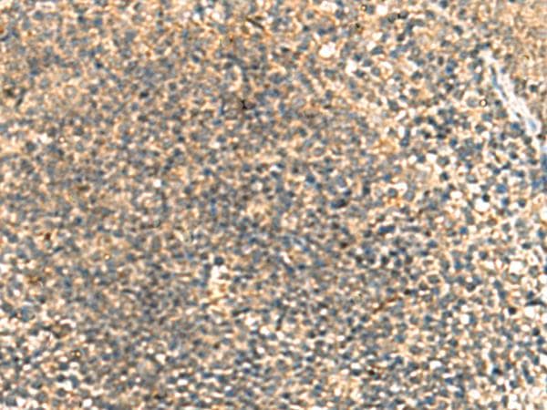 TCAP / Telethonin Antibody