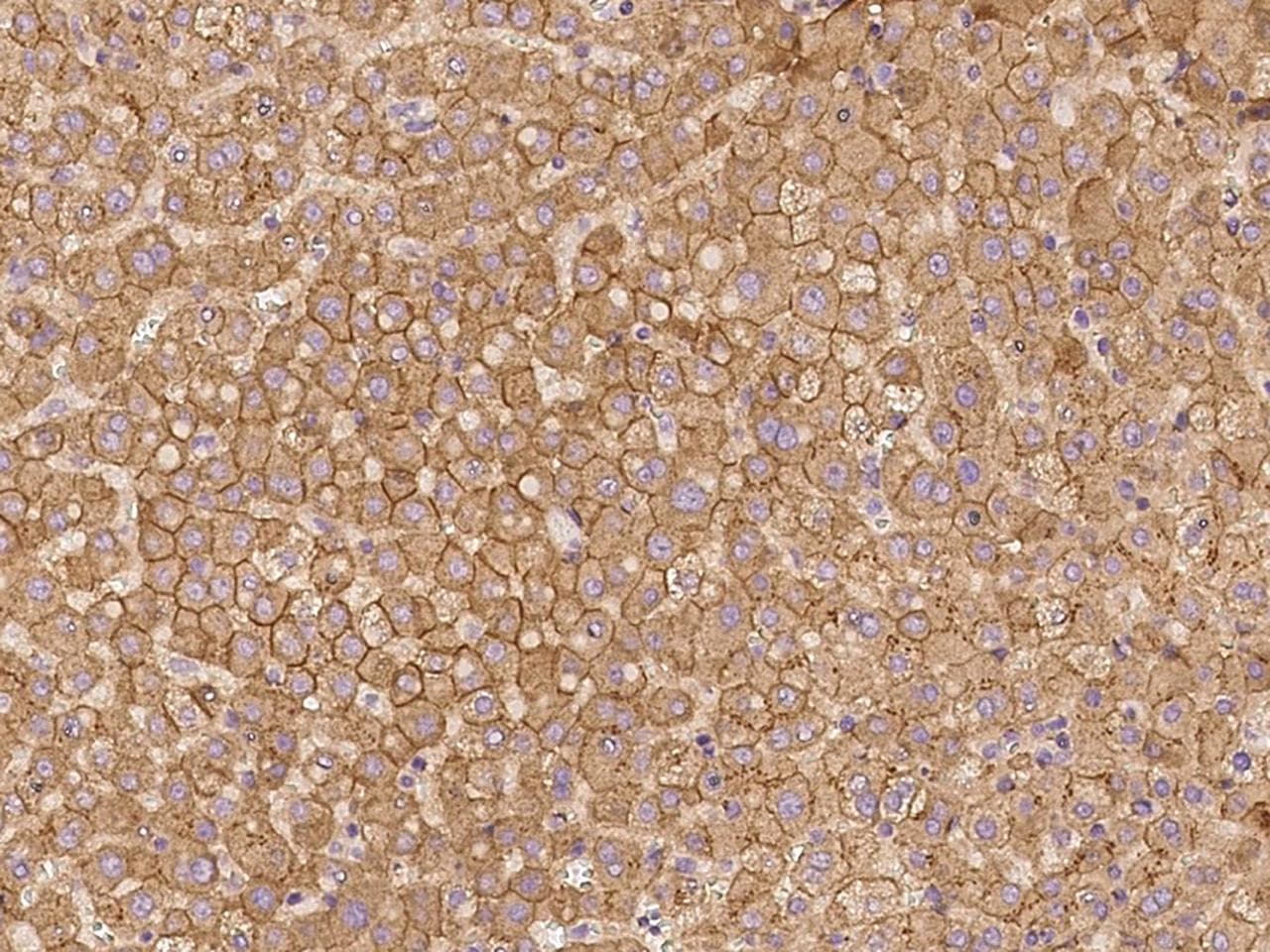 Polyclonal Rabbit anti-Human ZNF248 Antibody (IHC)