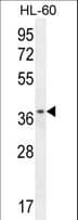 ZNF322 Antibody (aa326-354)