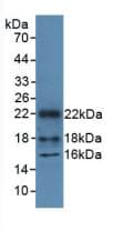 HMGN1 / HMG14 Antibody (aa1-96)