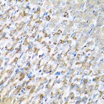 CST1 / Cystatin SN Antibody