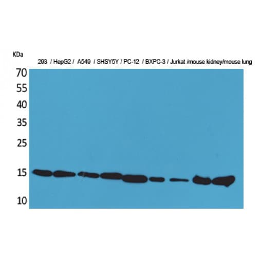 Polyclonal Rabbit anti-Human PPIA / Cyclophilin A Antibody (51-100 aa, Internal, WB)
