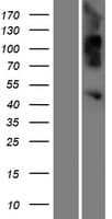 OVCA1 / DPH1 Protein (Over-Expression Lysate Myc-DDK (Flag))
