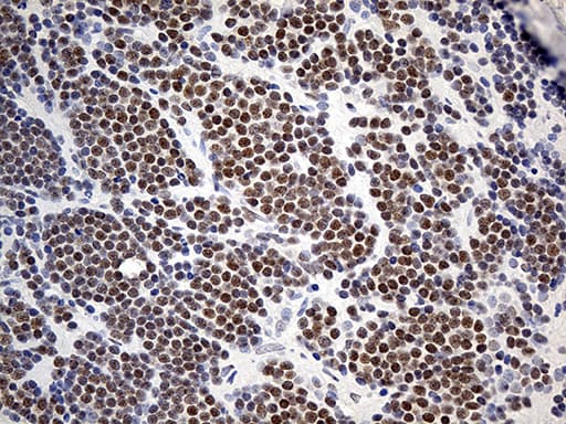 ZNF2 Antibody (clone OTI1G3)