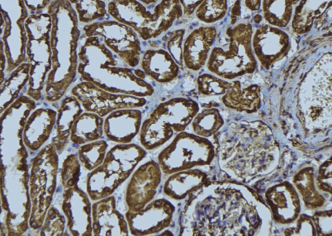 HLA-A Antibody