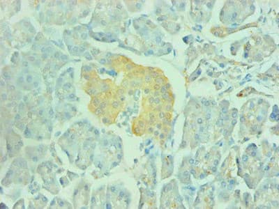 ENO2 / NSE Antibody (clone 4B1F5)