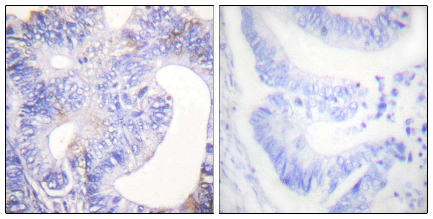 PLCG2 / PLC Gamma 2 Antibody (phospho-Tyr753)