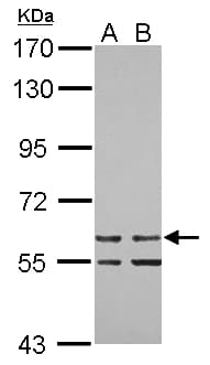 ZNF419 Antibody