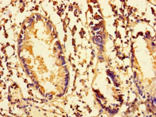 Polyclonal Rabbit anti-Human MRPS28 Antibody