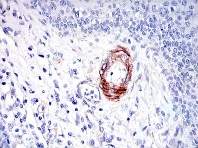 Monoclonal Mouse anti-Human GKAP1 Antibody (clone 3G4, IHC, IF, WB)