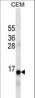 Insulin Antibody (aa35-64)