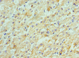 Polyclonal Rabbit anti-Human ACVR2 / ACVR2A Antibody (aa20-140, IHC)