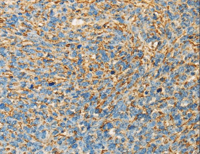 Polyclonal Rabbit anti-Human APOA4 Antibody (IHC)