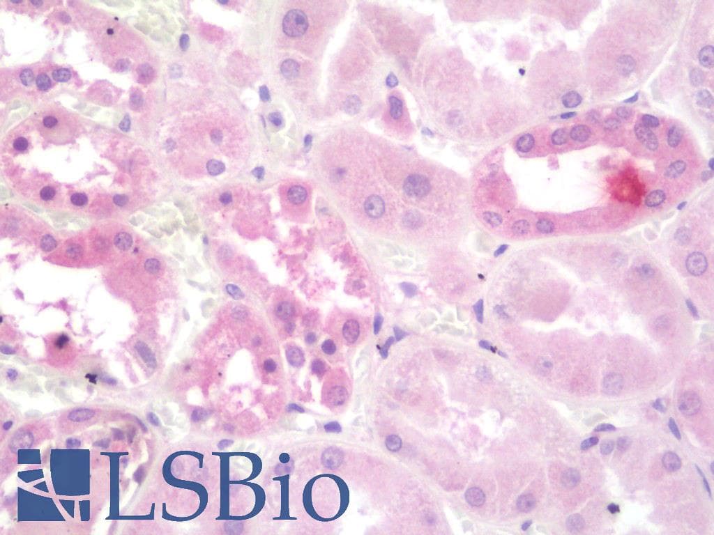 IHC-plus™ Polyclonal Rabbit anti-Human ATP6AP2 / Renin Receptor Antibody (aa205-234, IHC, WB)
