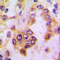 Polyclonal Rabbit anti-Human CASP9 / Caspase 9 Antibody (Internal, IHC, IF, WB)