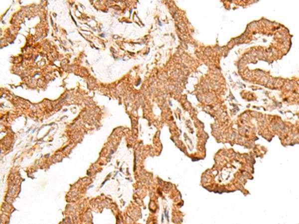 FER Antibody