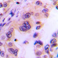 TSN / Translin Antibody (Internal)