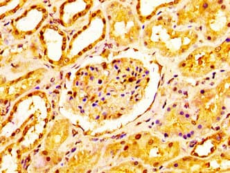 NDUFS2 Antibody