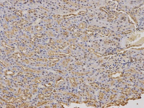 FXN / Frataxin Antibody