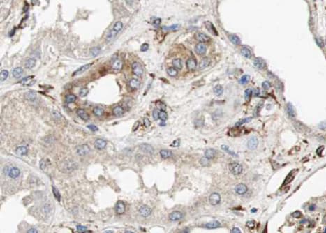AQP6 / Aquaporin 6 Antibody