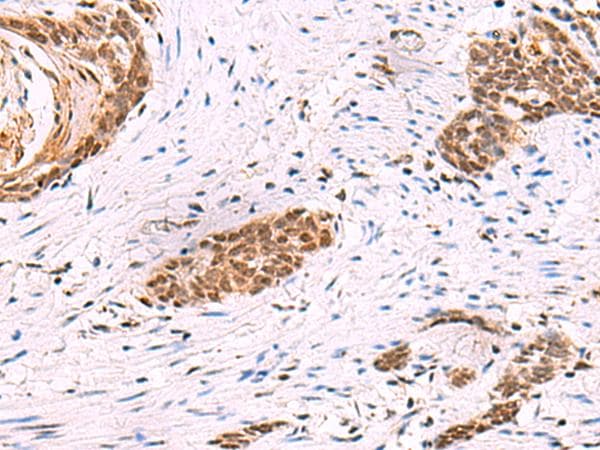 CREBBP / CREB Binding Protein Antibody