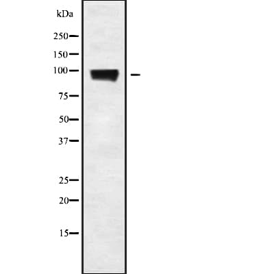 NLGN3 / Neuroligin 3 Antibody