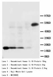 IL18 Antibody (aa175-193)