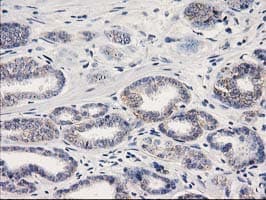 CTNNB1 / Beta Catenin Antibody (clone OTI1G1)