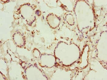 Polyclonal Rabbit anti-Human RNF114 / ZNF313 Antibody (IHC, WB)