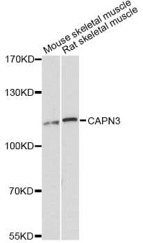 CAPN3 / Calpain 3 Antibody