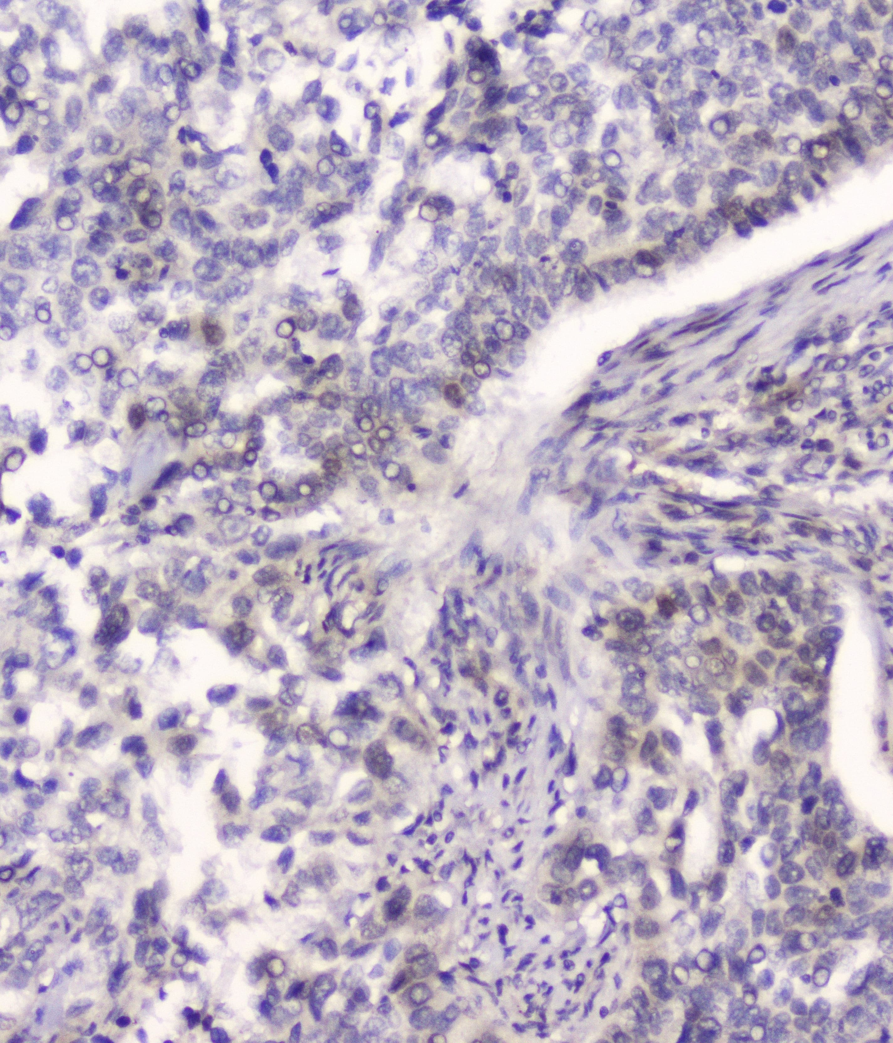 HSPA2 Antibody