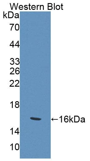 KLRK1 / CD314 / NKG2D Antibody (aa92-216)