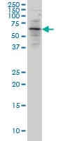 ALAS2 Antibody (clone 6C1)
