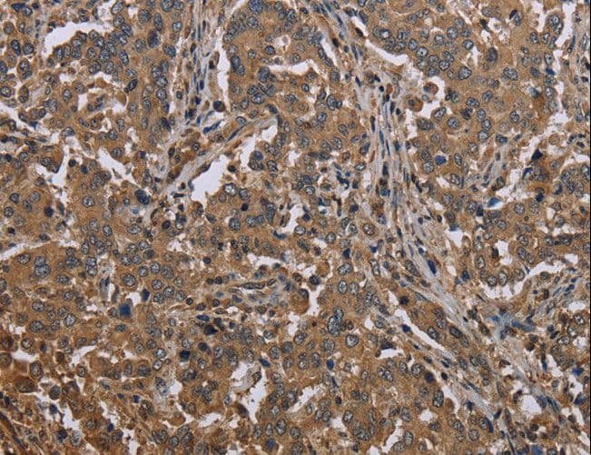 Polyclonal Rabbit anti-Human MCC Antibody (IHC)