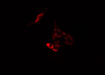 MPHOSPH9 Antibody
