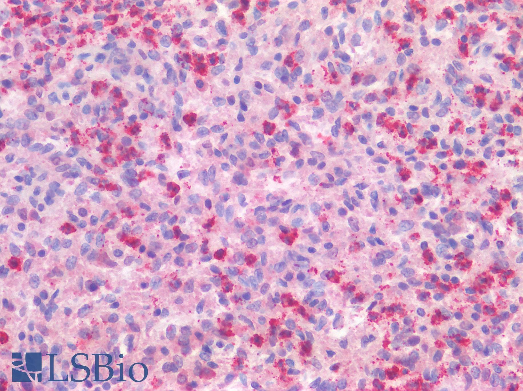 DGKA Antibody