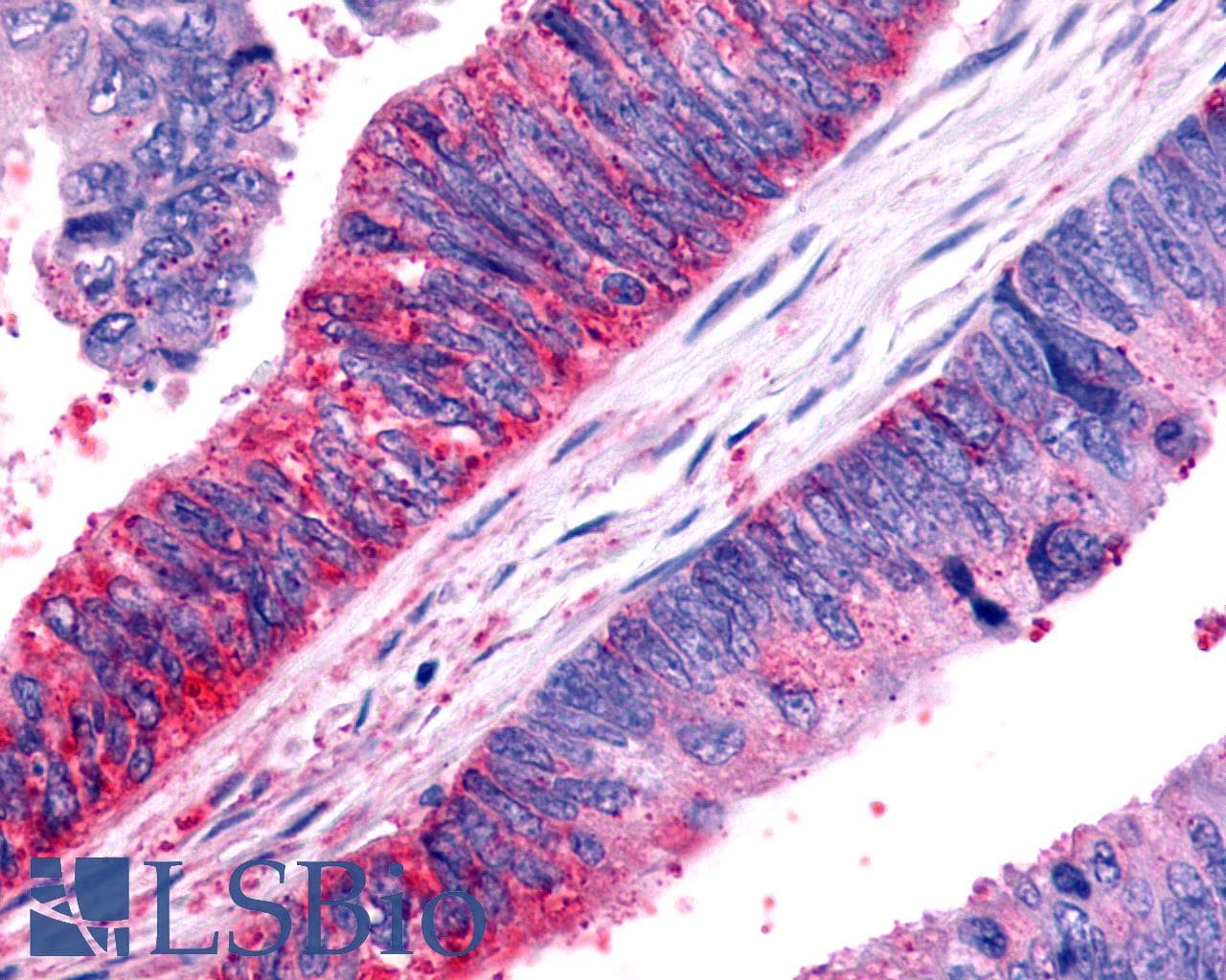 IHC-plus™ FZD7 / Frizzled 7 Antibody (N-Terminus)
