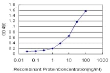 IHC-plus™ Monoclonal Mouse anti-Human CAMK2B / CaMKII Beta Antibody (clone S11, IHC, WB)