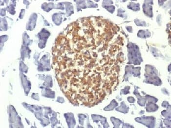 ENO2 / NSE Antibody (clone ENO2/1375)