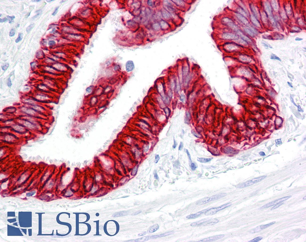 IHC-plus™ KRT19 / CK19 / Cytokeratin 19 Antibody (clone RCK108)