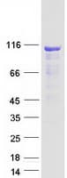 Human CEP104 Protein (Recombinant Myc-DDK (Flag))