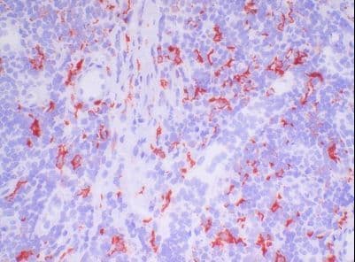 Macrophage Antibody (clone PM-2K)