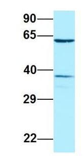 DYRK2 Antibody (aa434-483)