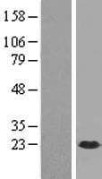 DUSP21 Protein (Over-Expression Lysate Myc-DDK (Flag))