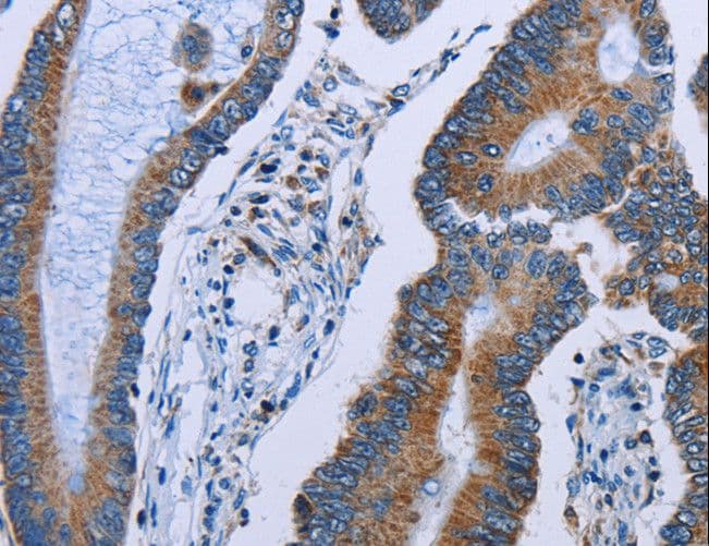 IDH2 Antibody